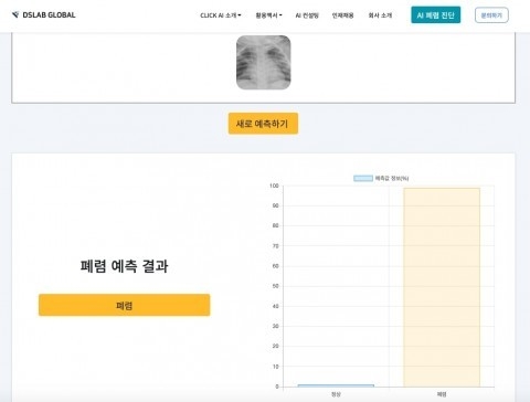 폐렴 AI 예측 서비스 화면